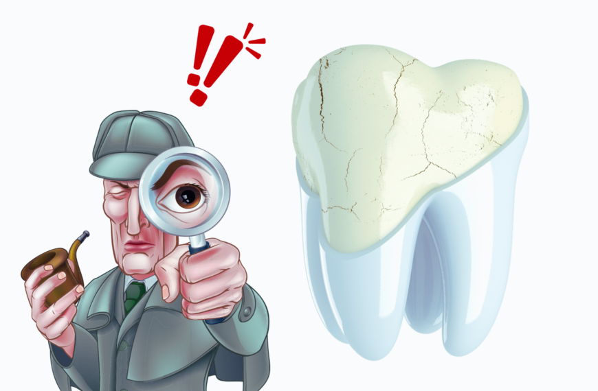 Sindrome del Dente Incrinato: Cos’è e Come si Interviene