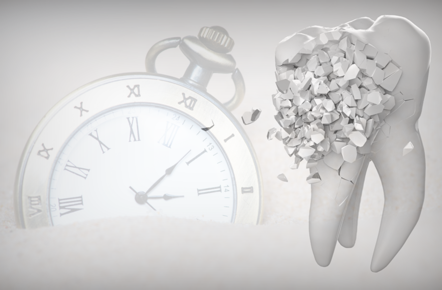 Quanto durano le otturazioni dentali?