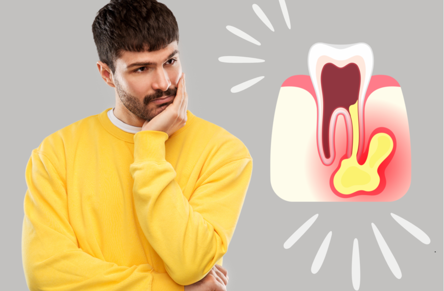 Cosa succede se un ascesso dentale non viene trattato?