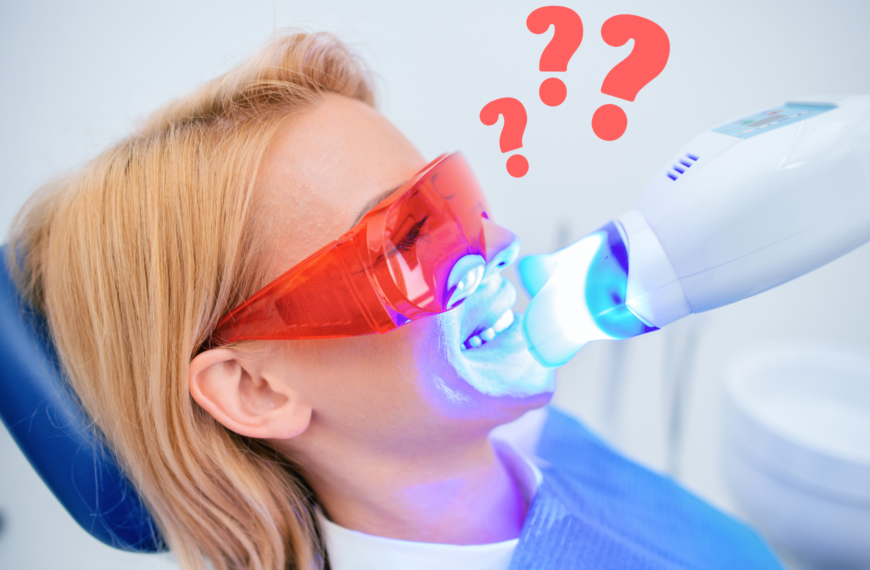 Ogni quanto posso sottopormi ad un nuovo sbiancamento dentale professionale?