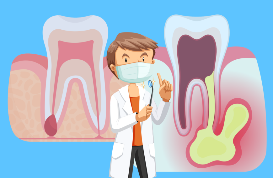 Che differenza c’è tra Granuloma e Ascesso?
