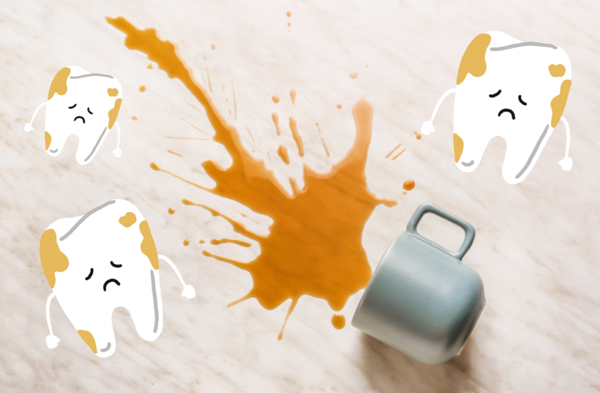 Tè e caffè possono causare macchie sui denti?