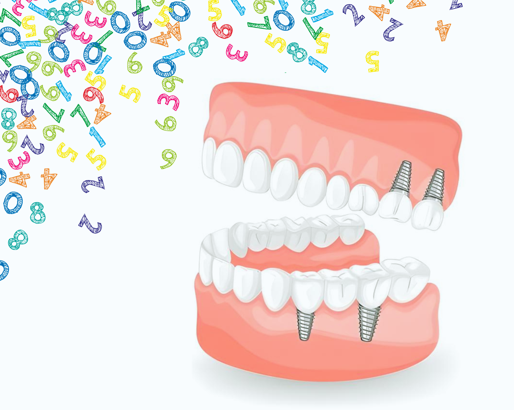 C’è un limite al numero di impianti dentali che possono essere posizionati nella mia bocca?