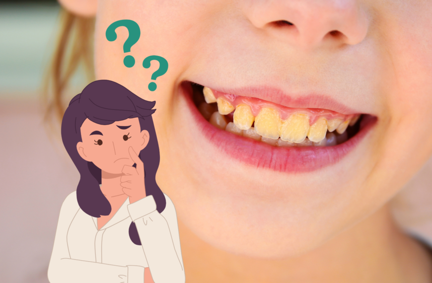 Perché ho i denti gialli?