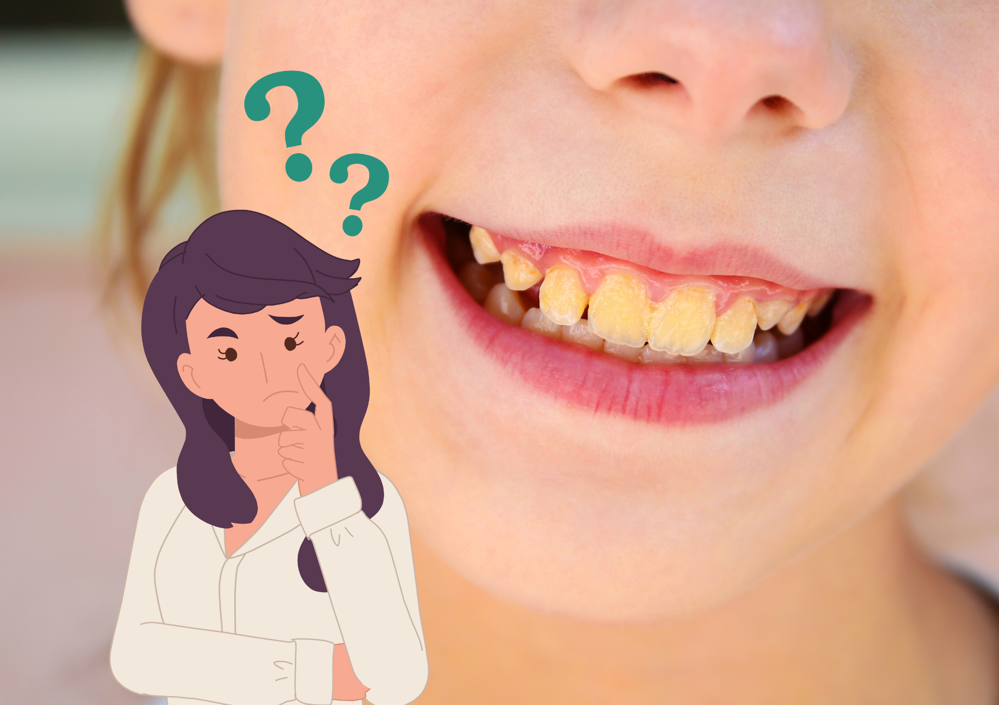 Perché ho i denti gialli?