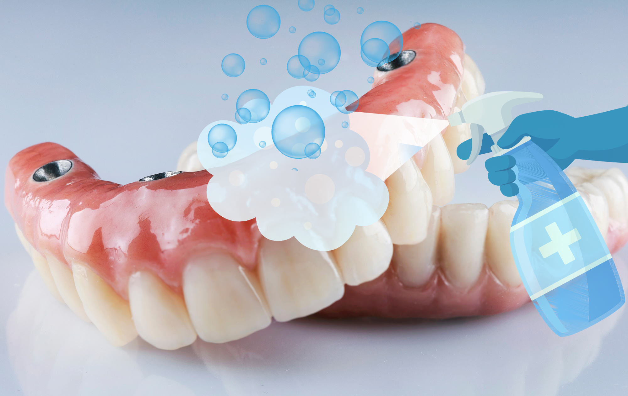 Protesi Totale su Impianti: Ogni Quanto Fare la Pulizia dal Dentista?