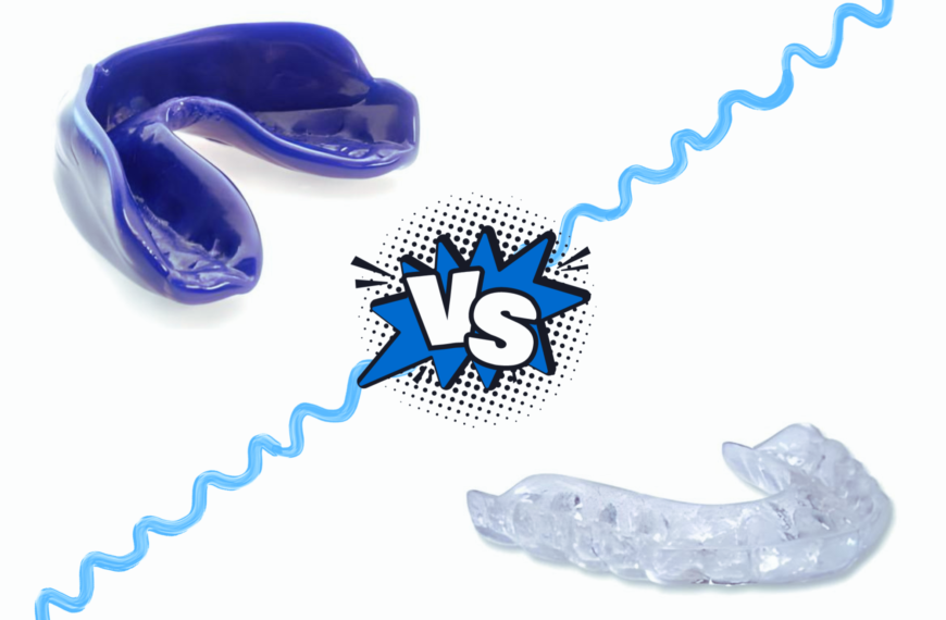 Qual è la Differenza tra Paradenti e Bite?