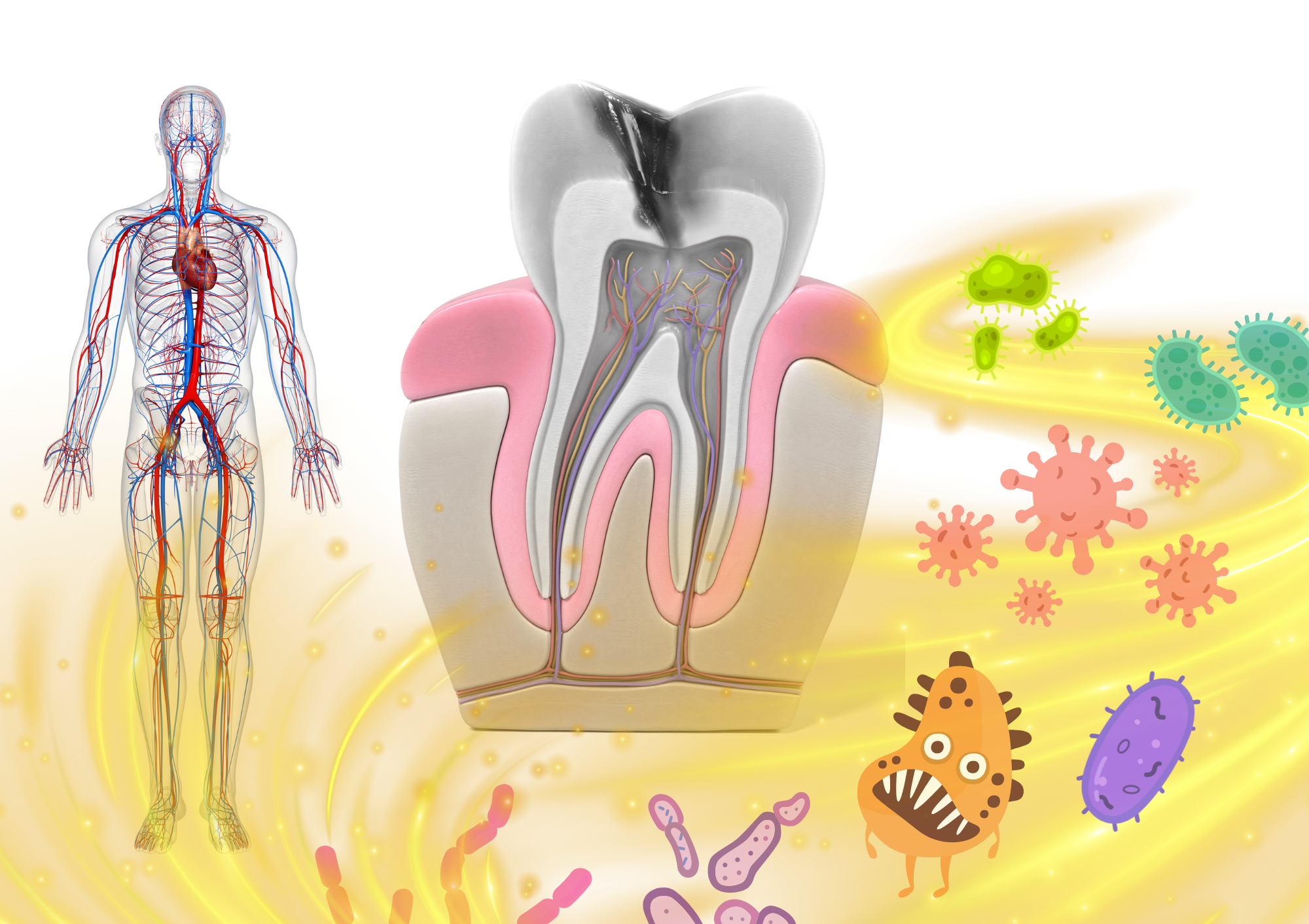 Cosa Succede se mi rifiuto di sottopormi a una Devitalizzazione Dentale