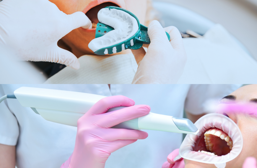 Impronta dentale: Digitale vs Tradizionale