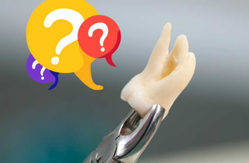 Quando e perché i denti del giudizio devono essere rimossi