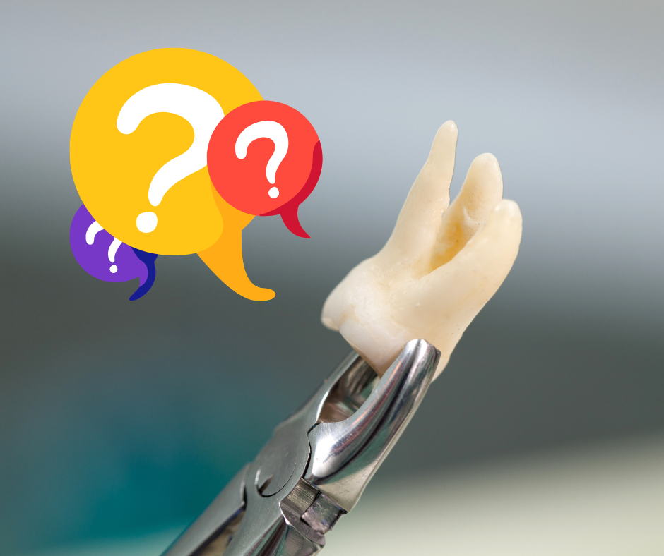Quando e perché i denti del giudizio devono essere rimossi