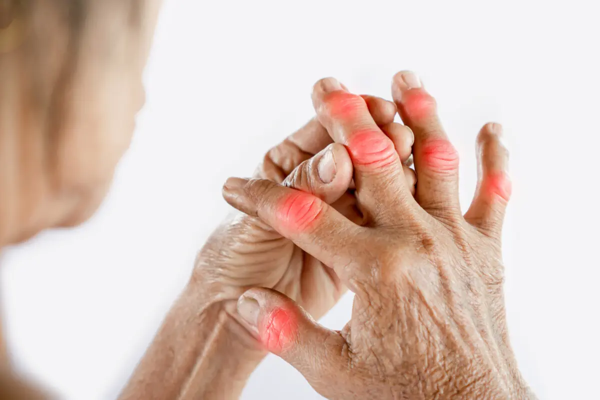 Esplorando il Legame tra Artrite e Igiena Orale: Come Mantenere un Sorriso Sano nonostante le sfide