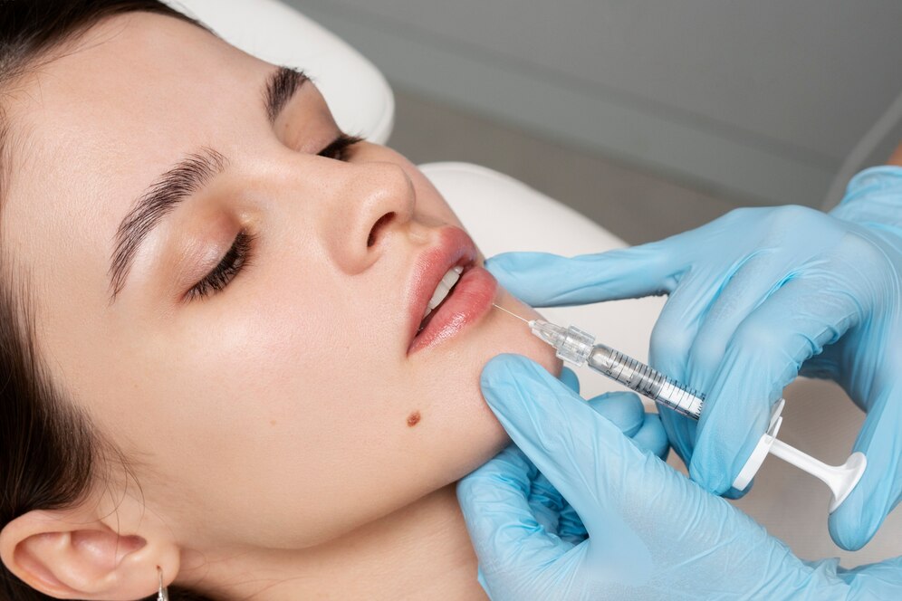 Che cosa sono i filler e come vengono utilizzati in odontoiatria