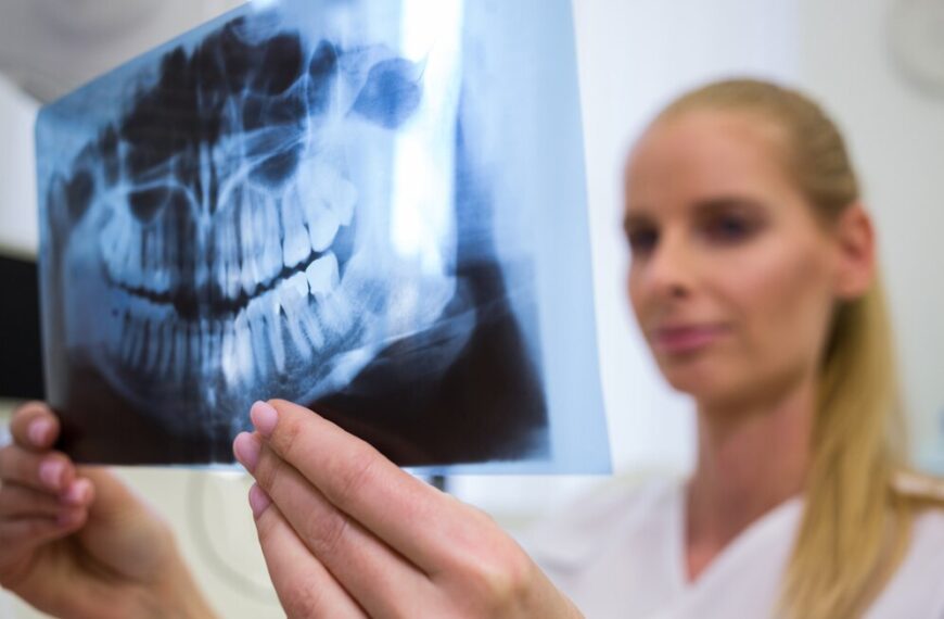 Posso Richiedere al Dentista una Copia della Radiografia Fatta in Studio?