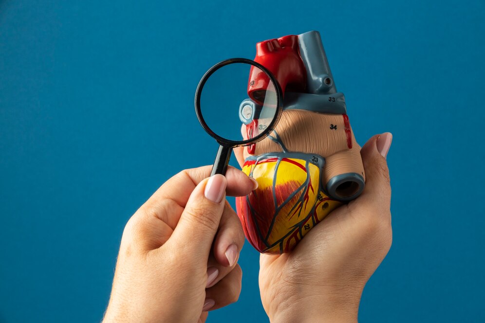 Cos’è un Infarto Cardiaco?