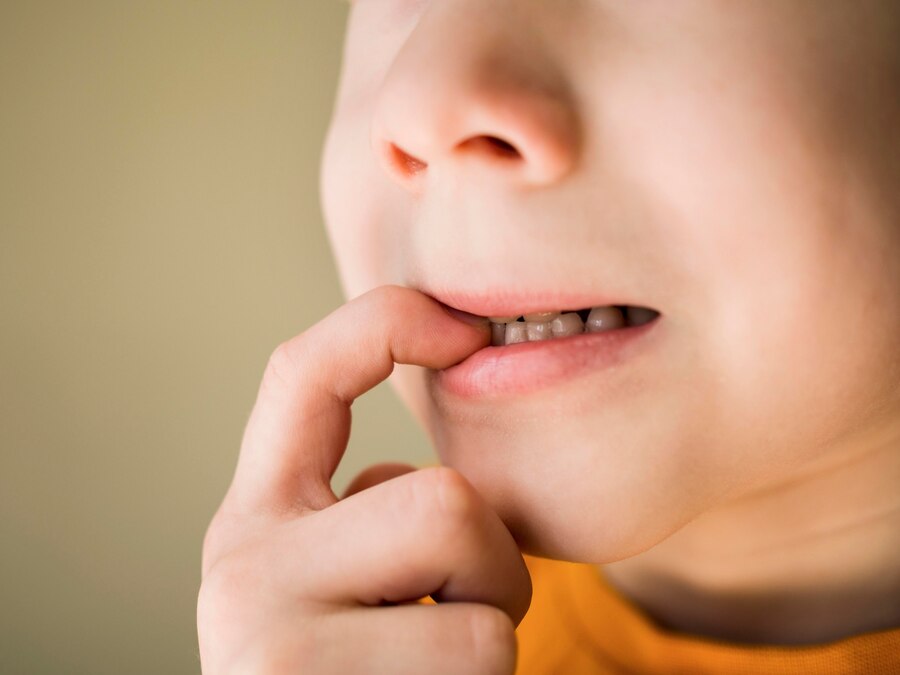 I Denti da Latte Fratturati Necessitano di Trattamenti Particolari?