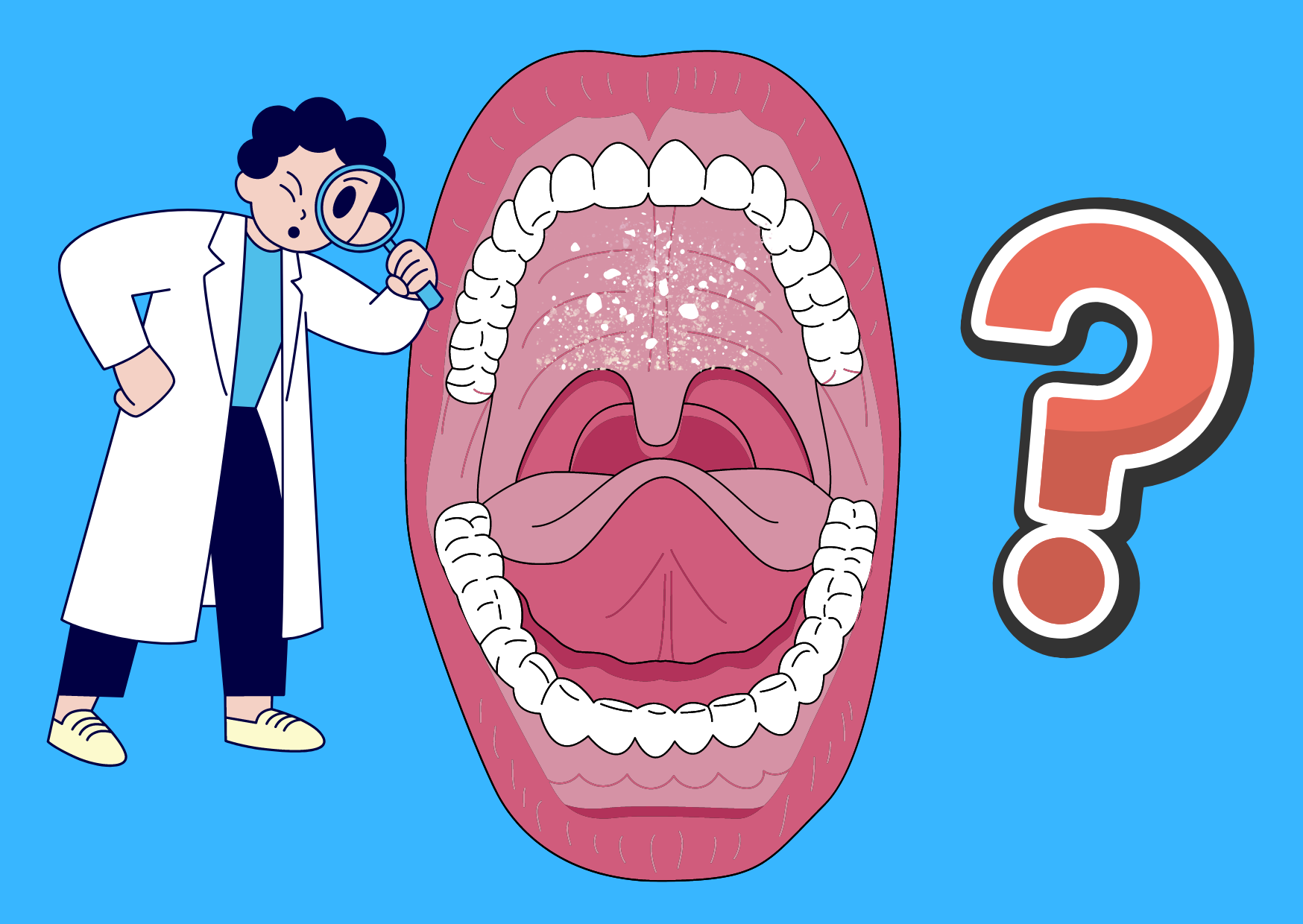 Macchie Bianche sul Palato: potrebbe essere Candida?