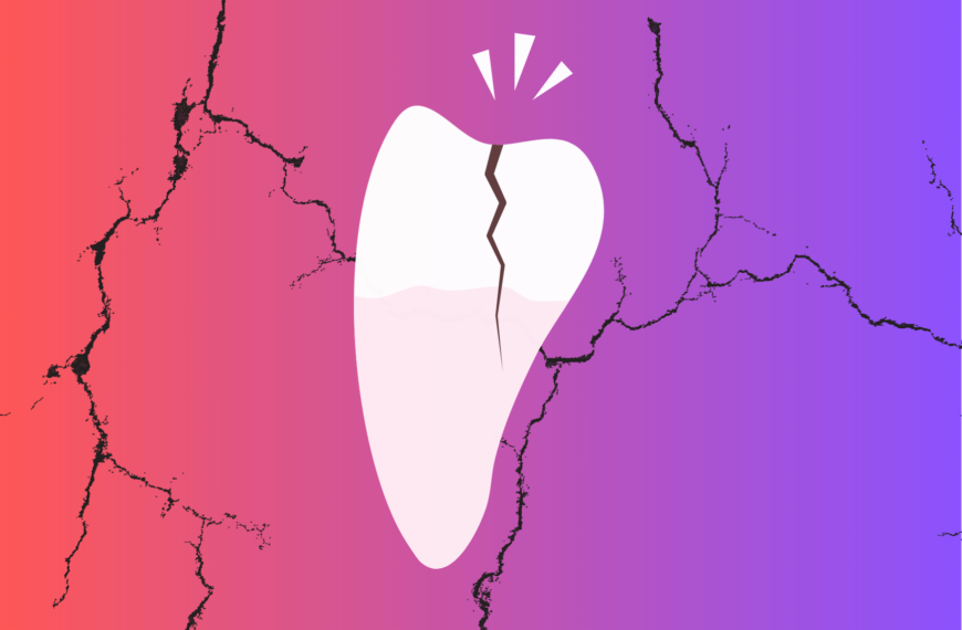 Quali sono i rischi di non trattare una frattura dentale?