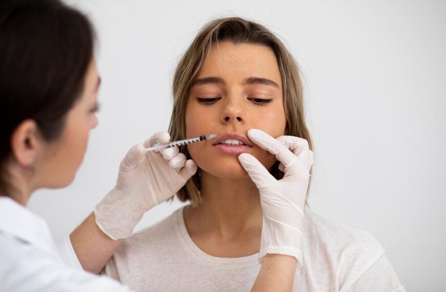 Come viene applicato il filler e quanto tempo richiede?