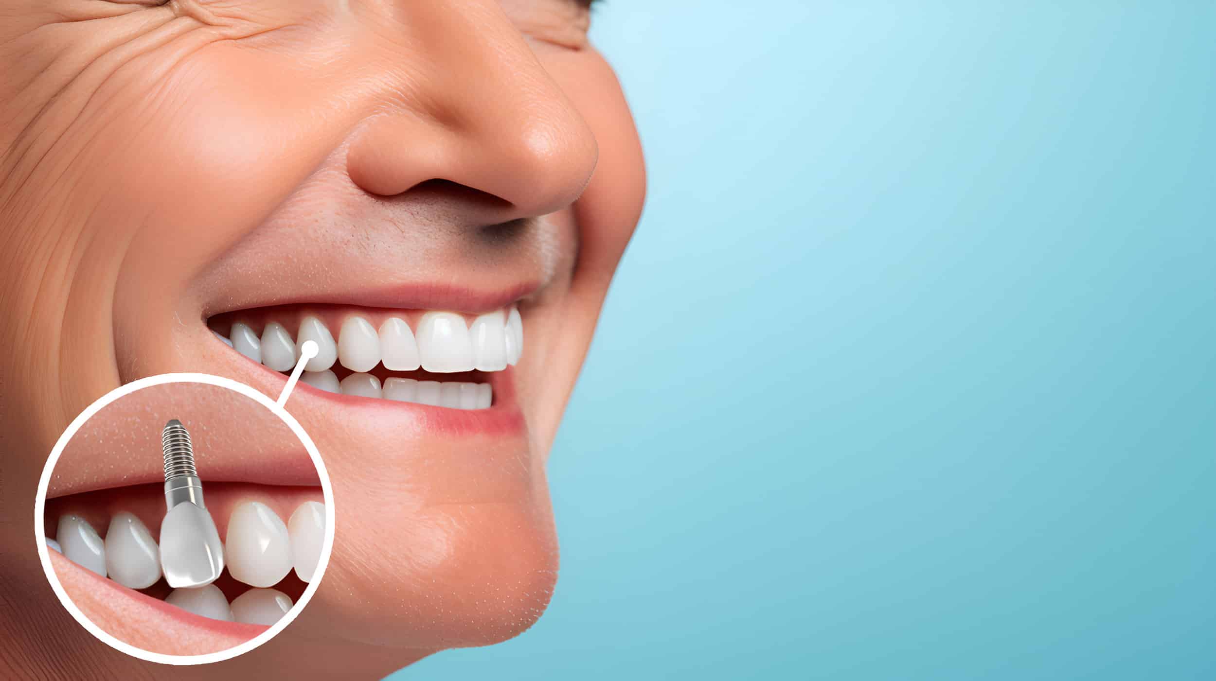 Come mantenere correttamente gli impianti dentali?