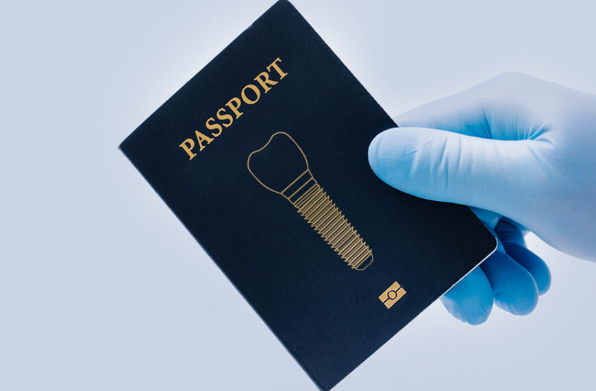 Cos’è il Passaporto Implantare?